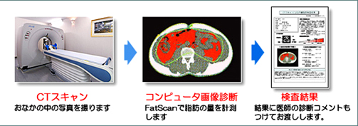 CTスキャン：おなかの中の写真を撮ります。コンピュータ画像診断：PCソフトウエアFatScanで脂肪の量を計測します。検査結果：結果に医師の診断コメントもつけてお渡しします。